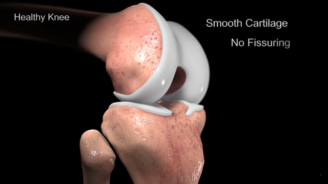 bai-viet/sun-xuong-co-tac-dung-gi-nhung-dieu-can-biet-ve-sun-xuong.html