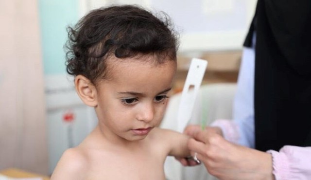 bai-viet/suy-dinh-duong-tre-em-nguyen-nhan-bieu-hien-va-cac-cham-soc.html