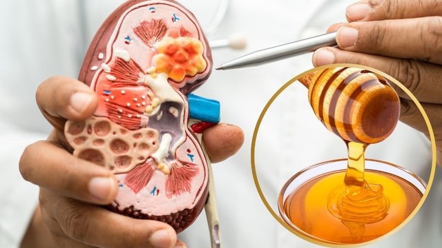 bai-viet/nguoi-bi-suy-than-co-uong-duoc-mat-ong-khong.html