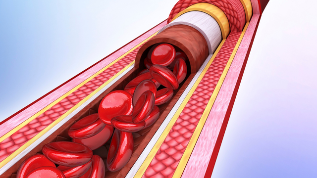 benh/tac-dong-mach-phoi-171.html