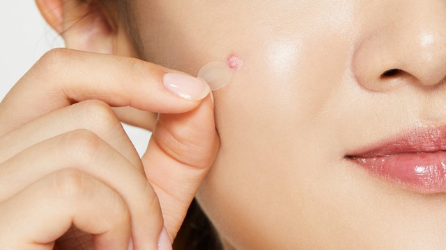 bai-viet/tac-hai-cua-mieng-dan-mun-la-gi-ban-da-biet-chua.html