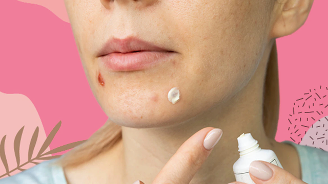 bai-viet/tac-hai-cua-viec-boi-kem-danh-rang-len-mat-doc-ngay-de-phong-tranh.html