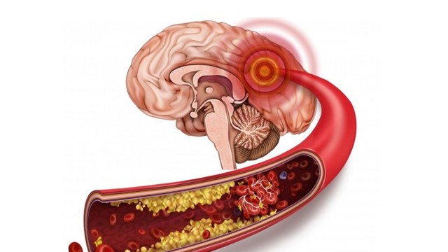 bai-viet/tac-nghen-mach-mau-nao-co-chua-duoc-khong-thoi-diem-vang-de-cuu-chua.html