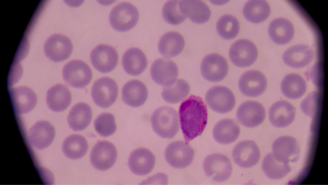 bai-viet/tac-nhan-gay-benh-sot-ret-la-gi-dau-hieu-va-bien-chung-cua-benh.html