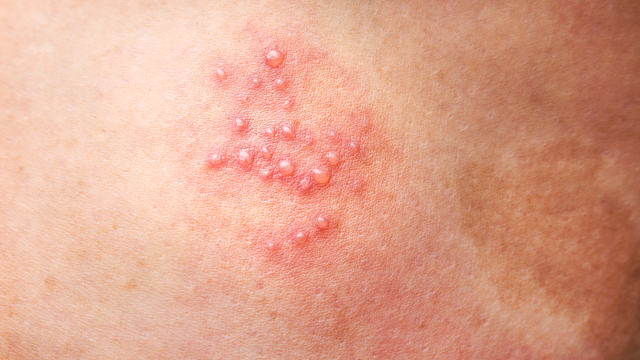 bai-viet/tai-sao-bi-gioi-leo-khong-duoc-noi-nhung-quan-niem-sai-lam-can-tranh.html