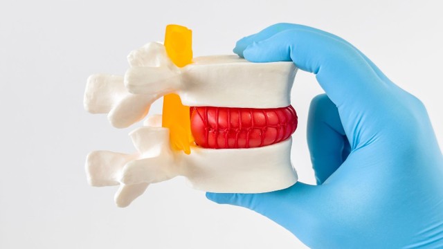 bai-viet/tai-sao-bi-thoat-vi-dia-dem-5-nguyen-nhan-gay-thoai-vi-dia-diem-thuong-gap.html