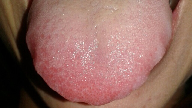 bai-viet/tai-sao-tren-luoi-co-vet-rang.html