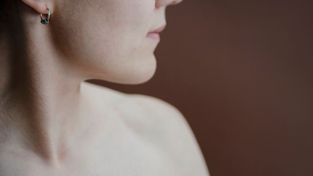 bai-viet/tai-sao-xuong-quai-ham-to-cach-khac-phuc-xuong-quai-ham-to.html