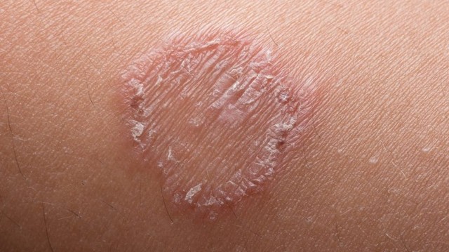 bai-viet/tam-la-gi-de-tri-hac-lao-nhanh-chong-va-hieu-qua-55468.html