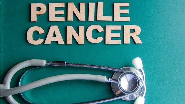 bai-viet/quy-trinh-tam-soat-ung-thu-duong-vat-va-mot-so-luu-y-khi-thuc-hien.html