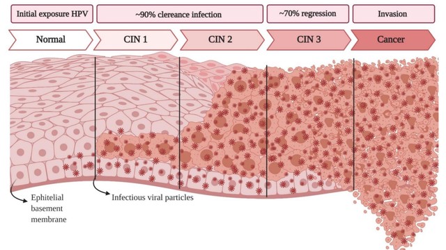 bai-viet/tan-sinh-la-gi-tim-hieu-ve-benh-ly-tan-sinh-bieu-mo-co-tu-cung.html