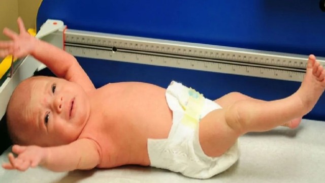 bai-viet/tang-truong-luc-co-o-tre-nguyen-nhan-trieu-chung-va-cach-dieu-tri.html