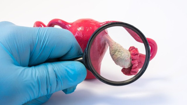 bai-viet/tat-tan-tat-nhung-dieu-can-biet-ve-u-quai-giap-buong-trung.html