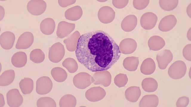 bai-viet/te-bao-khong-dien-hinh-la-gi-te-bao-khong-dien-hinh-co-phai-la-ung-thu.html