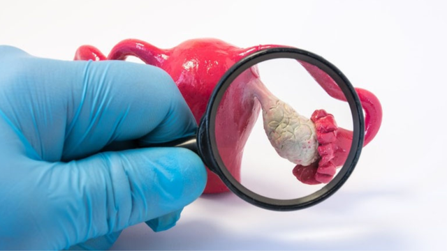 bai-viet/teratoma-la-gi-nhung-dau-hieu-va-trieu-chung-cua-teratoma.html