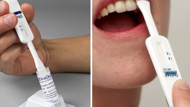 bai-viet/test-hiv-bang-nuoc-bot-co-chinh-xac-khong-cach-thuc-hien-nhu-the-nao.html