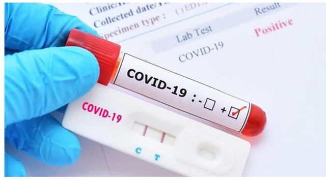 bai-viet/test-khang-the-covid-o-dau-va-nen-lam-khi-nao.html