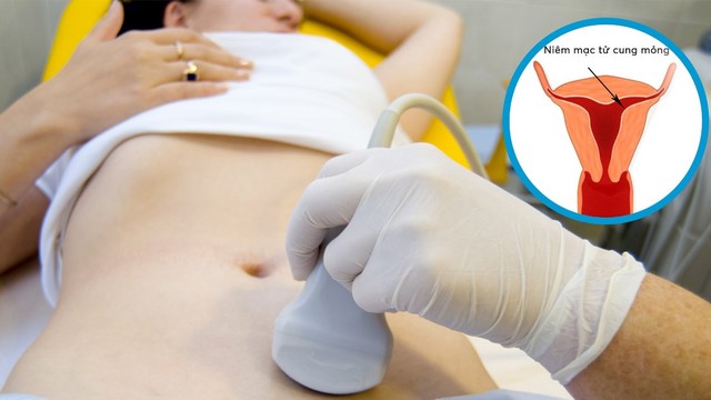 bai-viet/niem-mac-tu-cung-mong-la-gi-co-anh-huong-den-kha-nang-mang-thai-khong.html