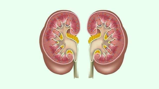 benh/than-nhiem-mo.html