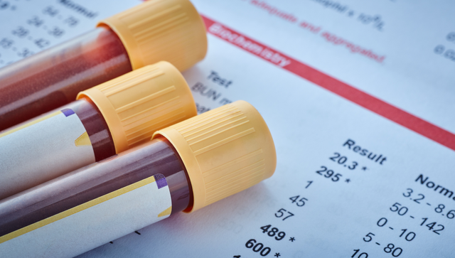 bai-viet/thang-diem-dic-cong-cu-chan-doan-hieu-qua-cho-roi-loan-dong-mau.html