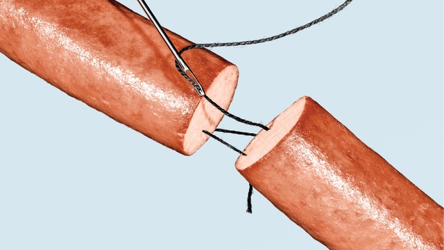 bai-viet/that-ong-dan-tinh-co-dau-khong-khi-nao-nen-that-ong-dan-tinh-64358.html