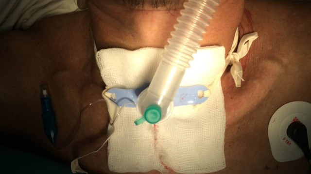 bai-viet/thay-bang-mo-khi-quan-duoc-thuc-hien-nhu-the-nao.html