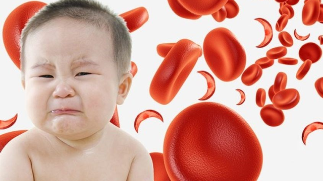 bai-viet/thieu-enzyme-g6-pd-o-tre-dau-hieu-nhan-biet-phuong-phap-chan-doan-va-cach-cham-soc.html