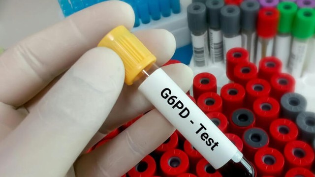 bai-viet/thieu-men-g6pd-la-benh-gi-tre-thieu-men-g6pd-khong-nen-an-gi-72441.html