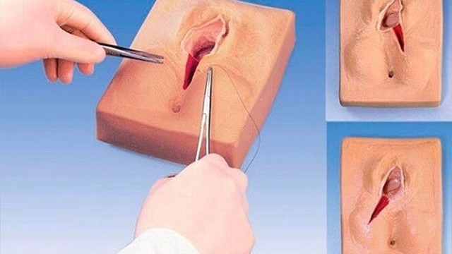 bai-viet/nguyen-nhan-gay-thit-thua-o-moi-be-phu-nu-cach-dieu-tri.html