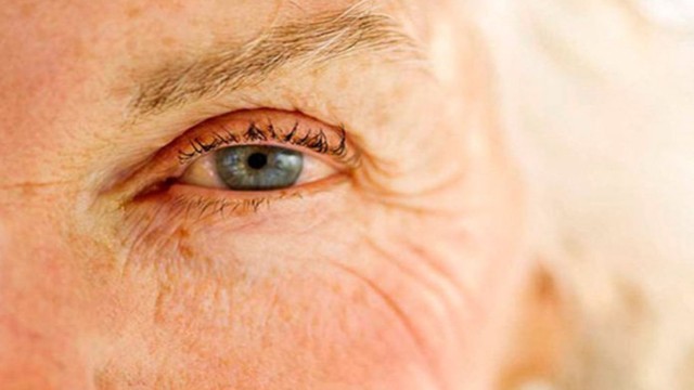 bai-viet/tim-hieu-chi-tiet-ve-benh-thoai-hoa-diem-vang-o-the-uot.html