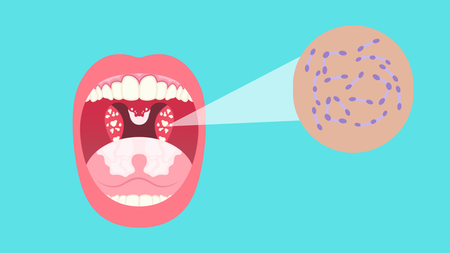 bai-viet/thoi-gian-u-benh-bach-hau-bao-lau-bien-phap-phong-ngua-benh.html