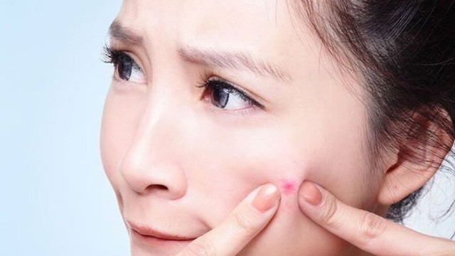 bai-viet/thoi-quen-giup-het-mun-nhanh-chong-hieu-qua.html