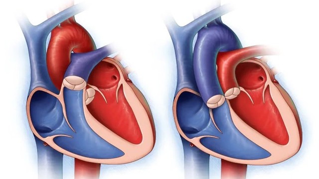 bai-viet/thong-lien-that-phan-mang-4mm-la-gi.html