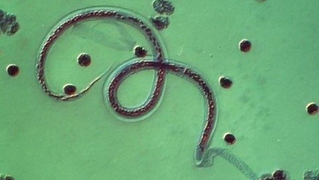 bai-viet/thong-tin-suc-khoe-loai-giun-nao-gay-ra-benh-chan-voi-o-nguoi-63812.html