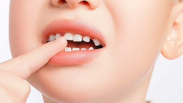 bai-viet/thu-tu-moc-rang-sua-o-tre-ma-bo-me-nen-biet.html