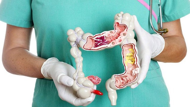 bai-viet/thuoc-rua-ruot-noi-soi-dai-trang-cach-su-dung-thuoc-an-toan-va-hieu-nghiem.html