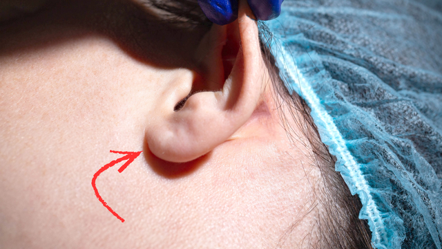 bai-viet/thuy-tai-la-gi-giai-phau-chuc-nang-va-nhung-dieu-can-biet-ve-thuy-tai.html