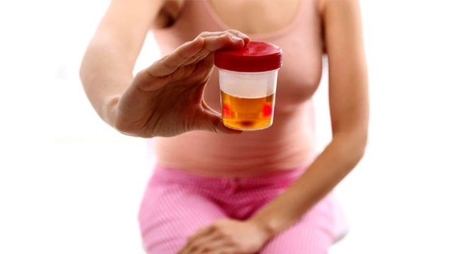 bai-viet/tieu-ra-mau-co-tu-khoi-khong-nguyen-nhan-tieu-ra-mau-la-gi.html