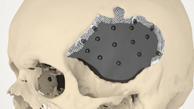 benh/tieu-xuong-so.html