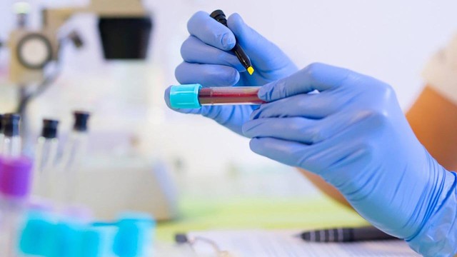 bai-viet/tim-hieu-chi-so-alt-kinetic-la-gi-khi-nao-can-thuc-hien-xet-nghiem-alt-kinetic.html