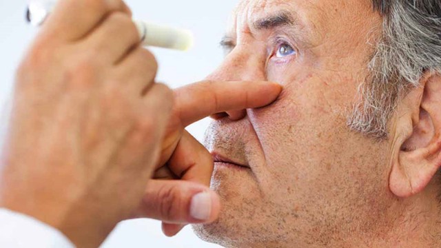 bai-viet/tim-hieu-ve-benh-ly-viem-mang-bo-dao-co-bi-lay-khong-55539.html