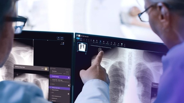 bai-viet/tim-hieu-ve-buoc-song-cua-tia-x-va-ung-dung-cua-tia-x-trong-y-hoc.html