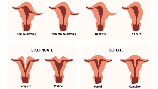 bai-viet/tim-hieu-ve-di-dang-sinh-duc-nu.html