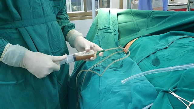 bai-viet/tim-hieu-ve-ky-thuat-mo-mang-phoi-toi-thieu.html