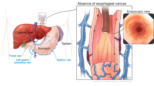 bai-viet/tim-hieu-that-tinh-mach-thuc-quan-qua-noi-soi.html