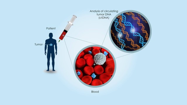 bai-viet/tim-hieu-ve-xet-nghiem-dna-khoi-u-tuan-hoan.html