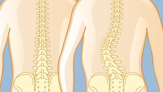 bai-viet/tim-hieu-veo-cot-song-o-thanh-thieu-nien-va-cach-dieu-tri.html