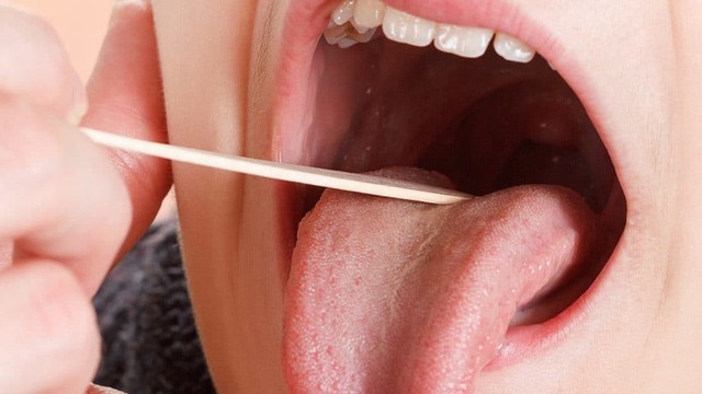 bai-viet/tinh-trang-viem-va-la-gi-nguyen-nhan-gay-benh-va-cach-xu-tri-cho-tre-ma-cha-me-nen-biet.html