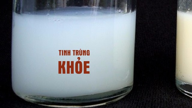 bai-viet/tinh-trung-mau-trang-sua-co-tot-khong.html