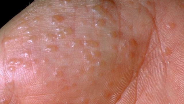 bai-viet/to-dia-co-lan-khong-57888.html